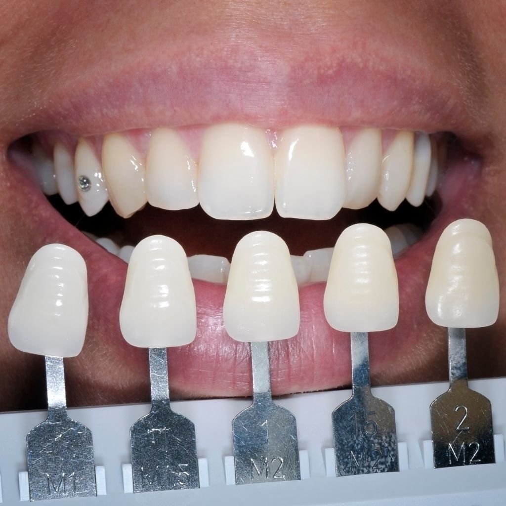 Odontologia Estética